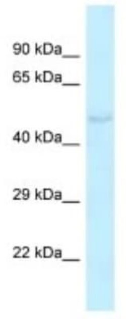 Kv6.4 Rabbit anti-Rat, Polyclonal, Novus Biologicals 100 &mu;g; Unconjugated:Antibodies,